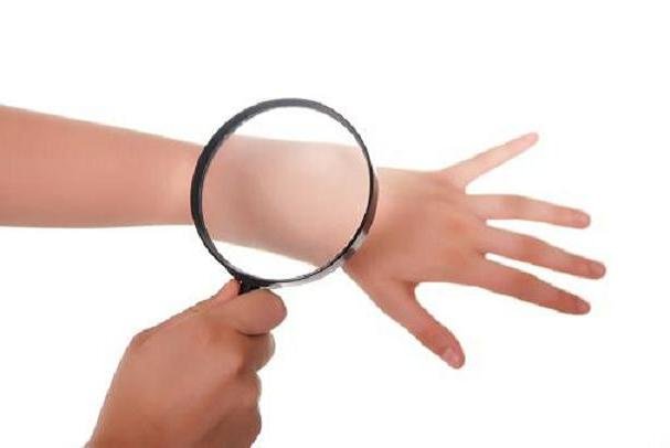 آنتی هیستامین به عمر بیشتر بیماران سرطان پوست کمک می کند