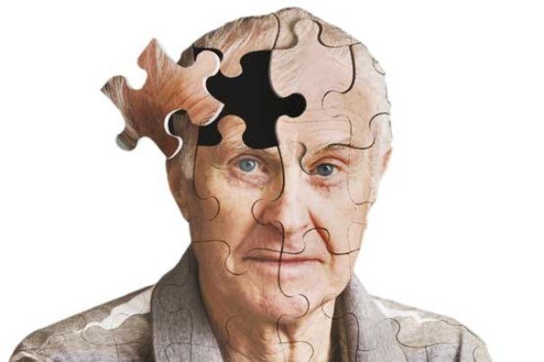 پنج راهکار اصلی کاهش احتمال ابتلا به آلزایمر را بشناسید